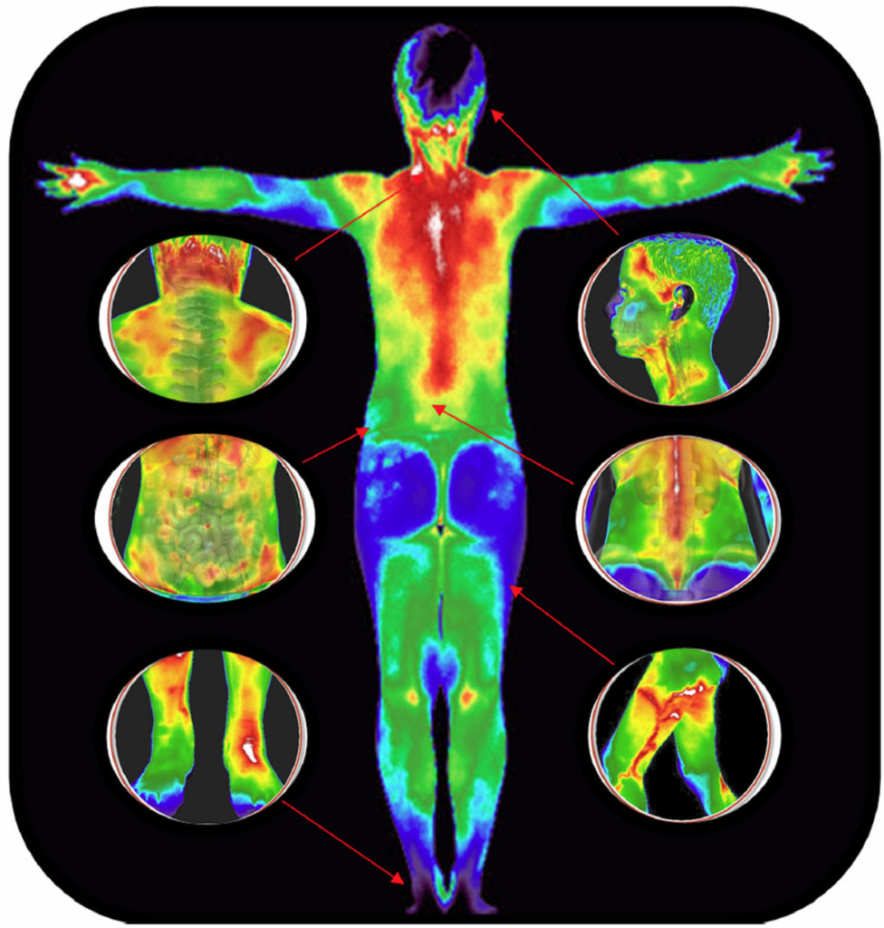 Thermography. Breast health naturally herbs functional nutition.